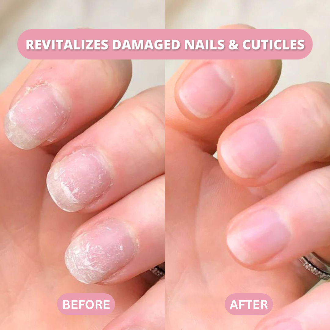Stem Cells Nail Growth Pen (Copy)