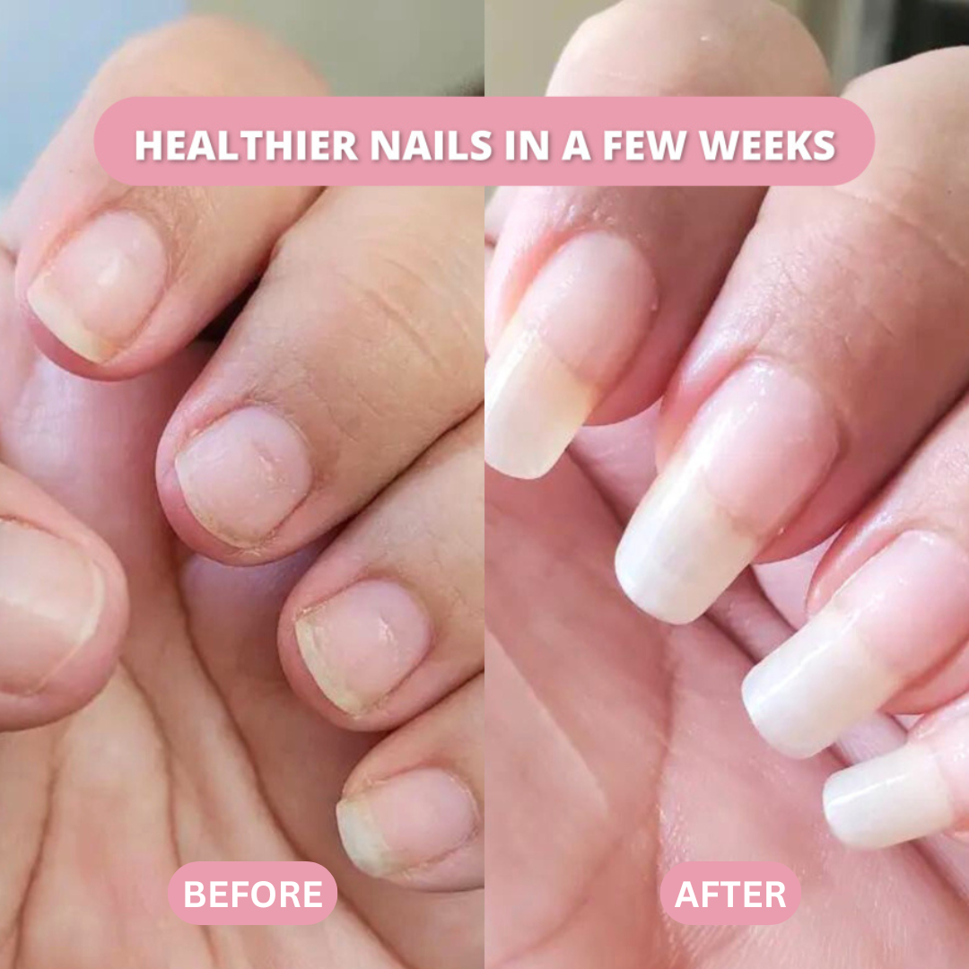 Stem Cells Nail Growth Pen (Copy)